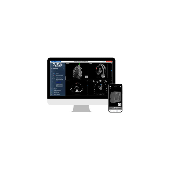 Sony Spatial Reality Display and 3Dicom Medical Images Viewer Bundle