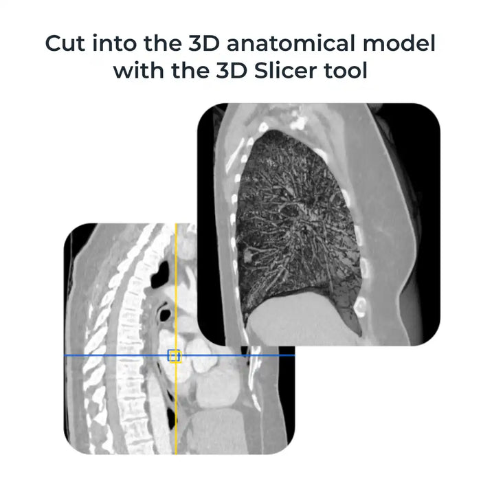 3Dicom Viewer Software - Patient at knoxlabs.com VR marketplace