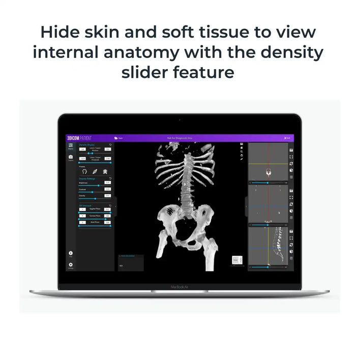 3Dicom Viewer Software - Patient at knoxlabs.com VR marketplace