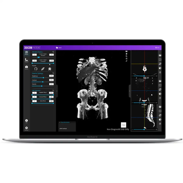 3Dicom Viewer Software - Patient at knoxlabs.com VR marketplace