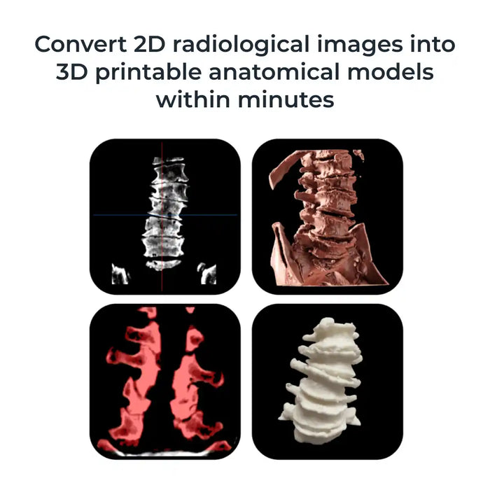 3Dicom Viewer Software - R&D at knoxlabs.com VR marketplace