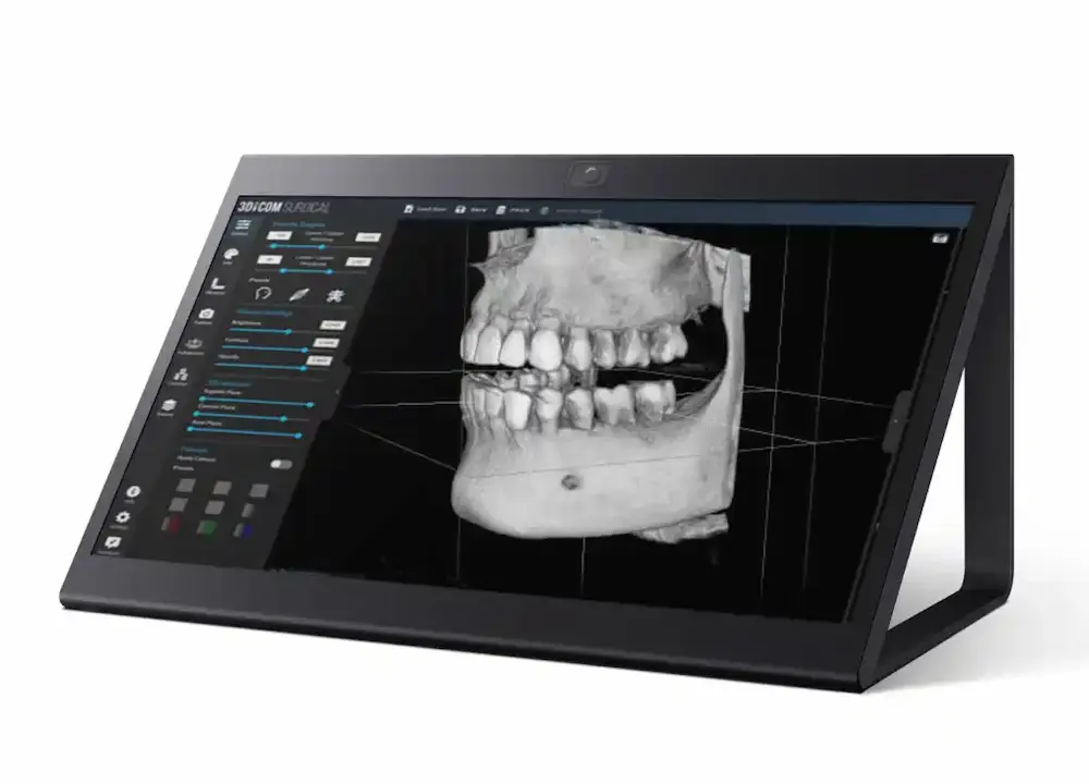 Introducing the Sony Spatial Reality Display and 3Dicom Medical Images Viewer Bundle